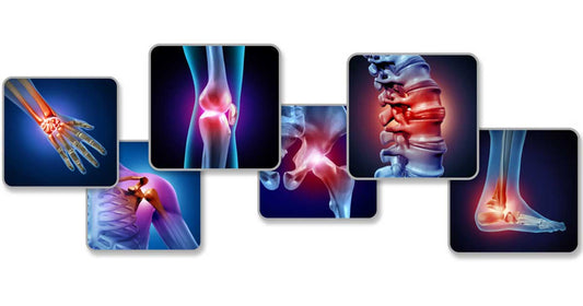 Top Ways to Improve Bone Health Naturally
